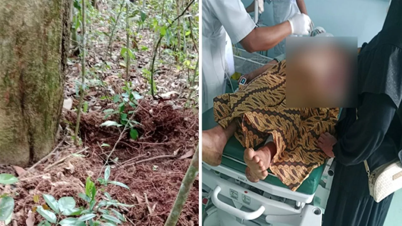Diserang Beruang Saat Hendak ke Kebun, Warga Air Beliti Musi Rawas Alami Luka Robek